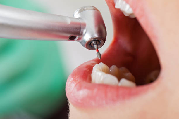 Best Emergency Cosmetic Dentistry (e.g., broken veneers) in Swartz Creek, MI